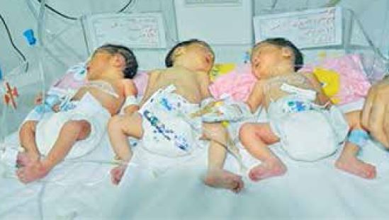 واریز کمک ۴۰۰هزار تومانی برای ۳قلوها