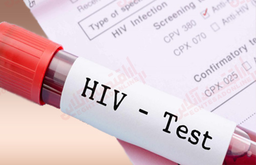 آخرین-وضعیت-شیوع-hiv-در-ایران