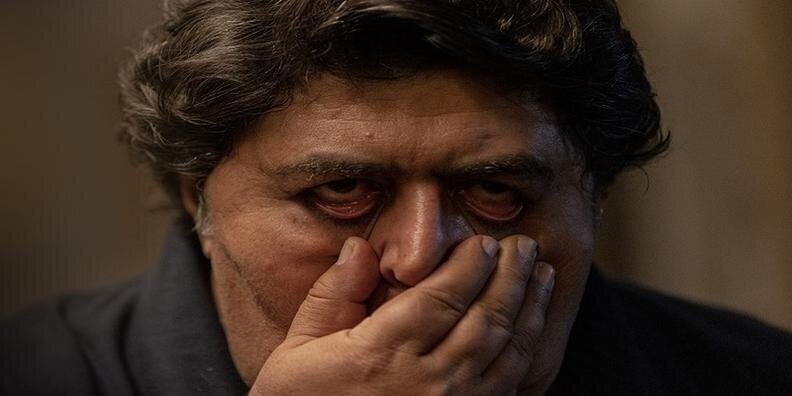 چهره عجیب فرهاد اصلانی سوژه شد