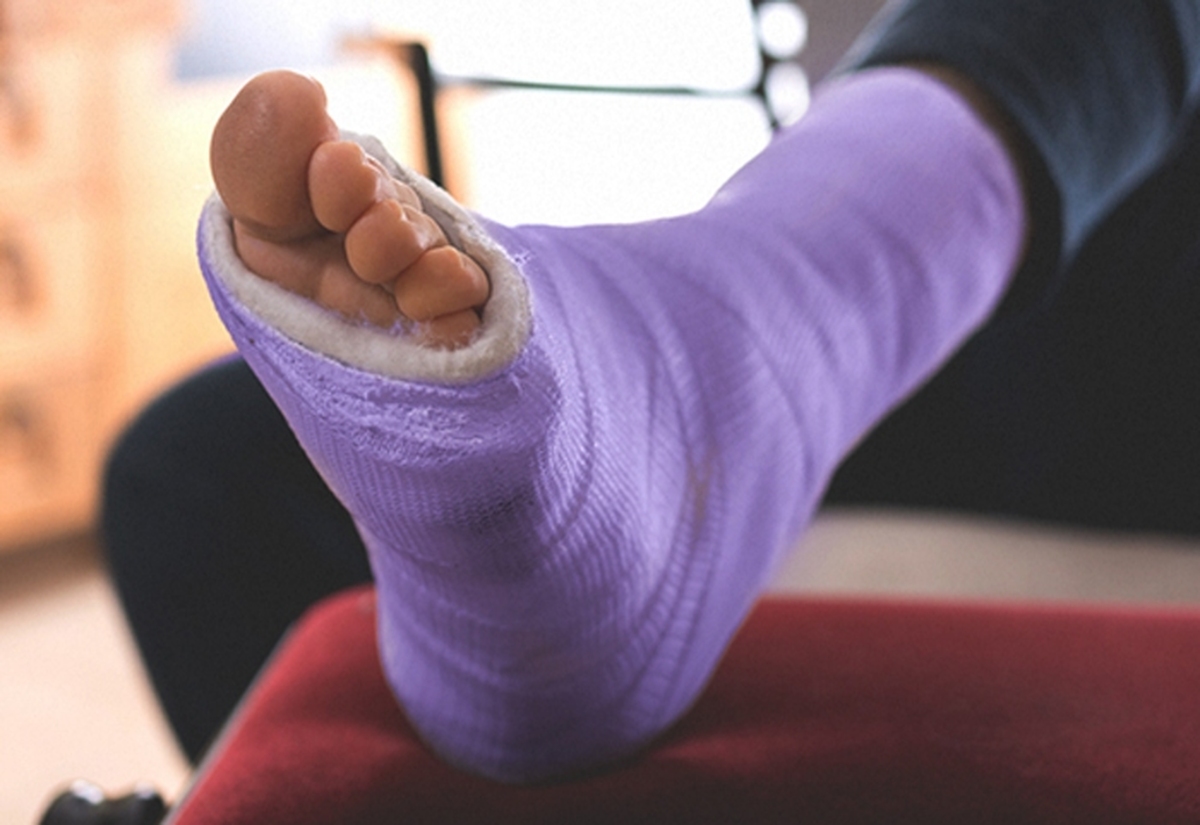 نسل جدید ارههای گچبری پزشکی + فیلم نسل جدید ارههای گچبری پزشکی + فیلم