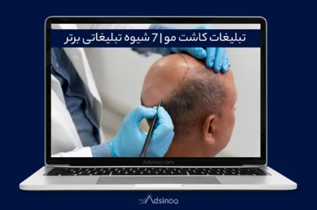 شرایط تاسیس کلینیک کاشت مو چیست؟ بررسی 0 تا 100 مراحل