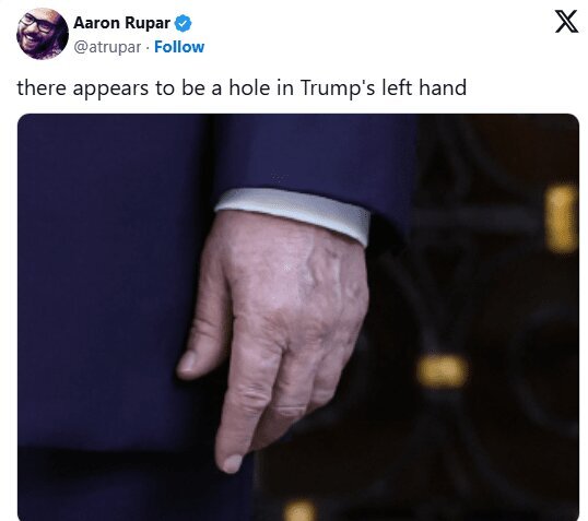 تصاویر دست ترامپ جنجال‌ساز شد/ حدس‌وگمان‌ها درباره سلامتی او