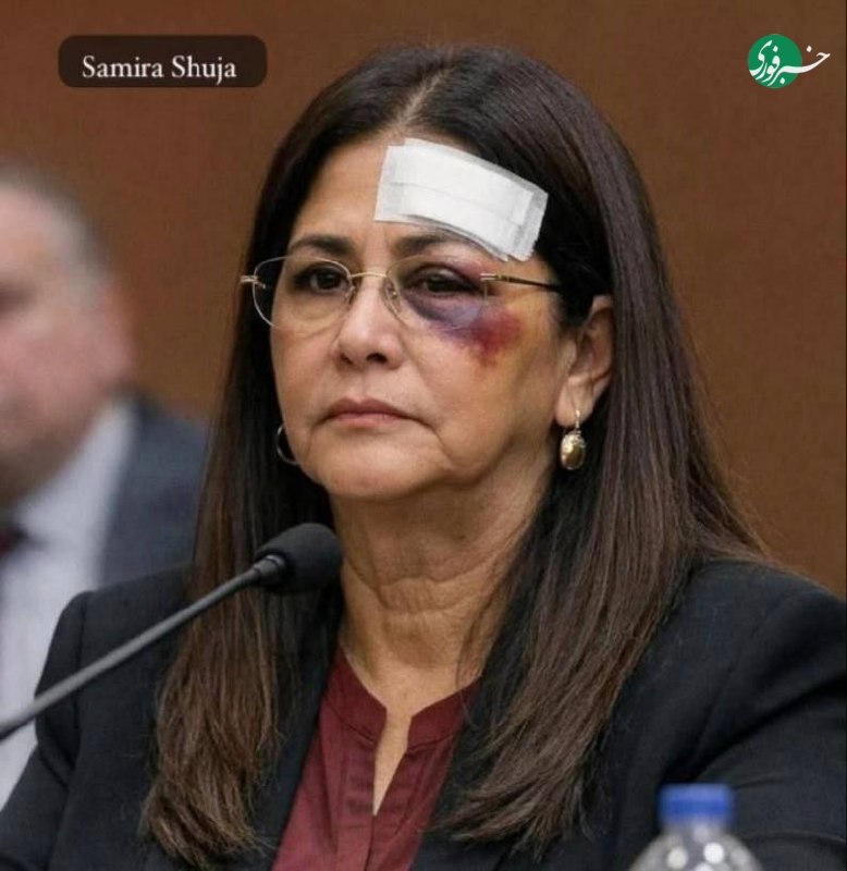 عکسی از چشم کبود همسر مادورو / سیلیا فلورس شکنجه شد؟