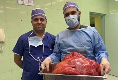 خارج کردن توده ۲۳ کیلویی از شکم یک زن میانسال در تبریز