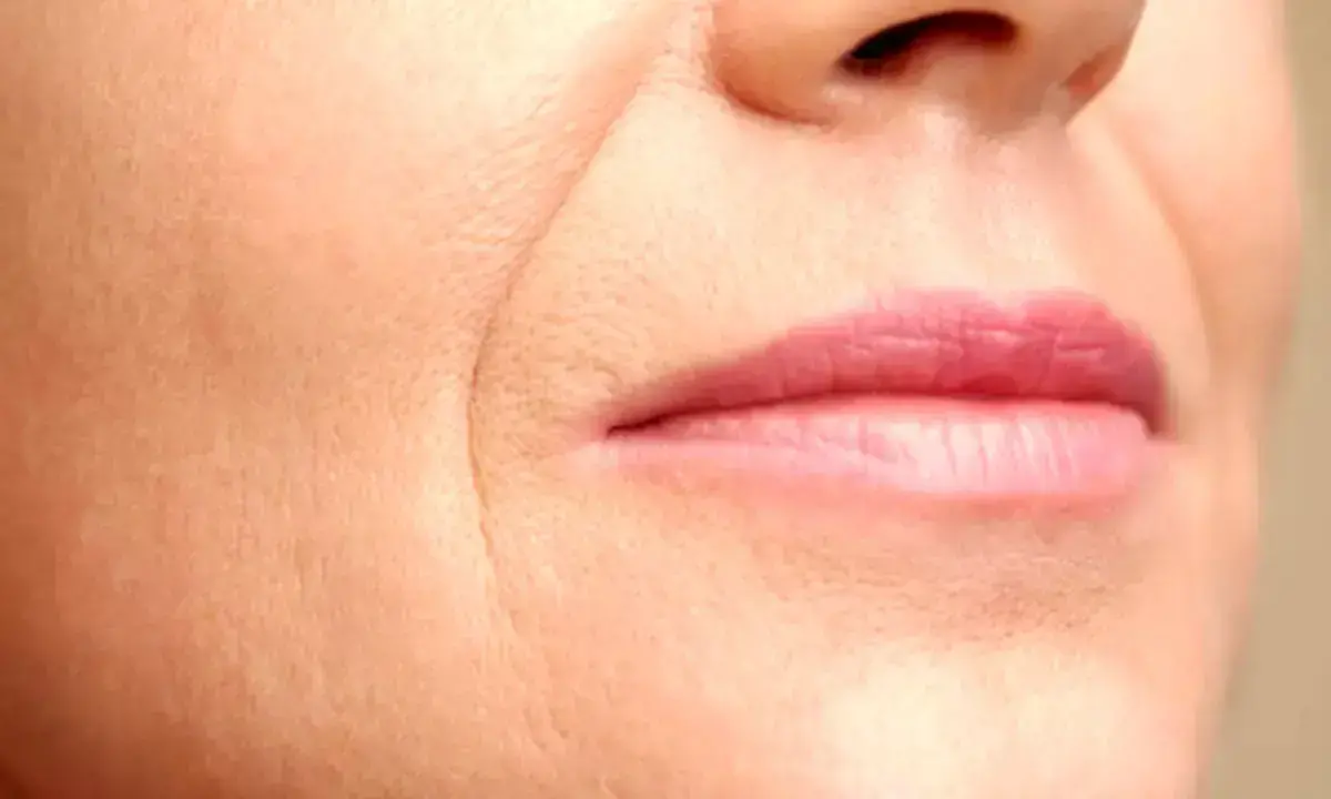 دلیل نازک شدن لب‌ها با بالا رفتن سن