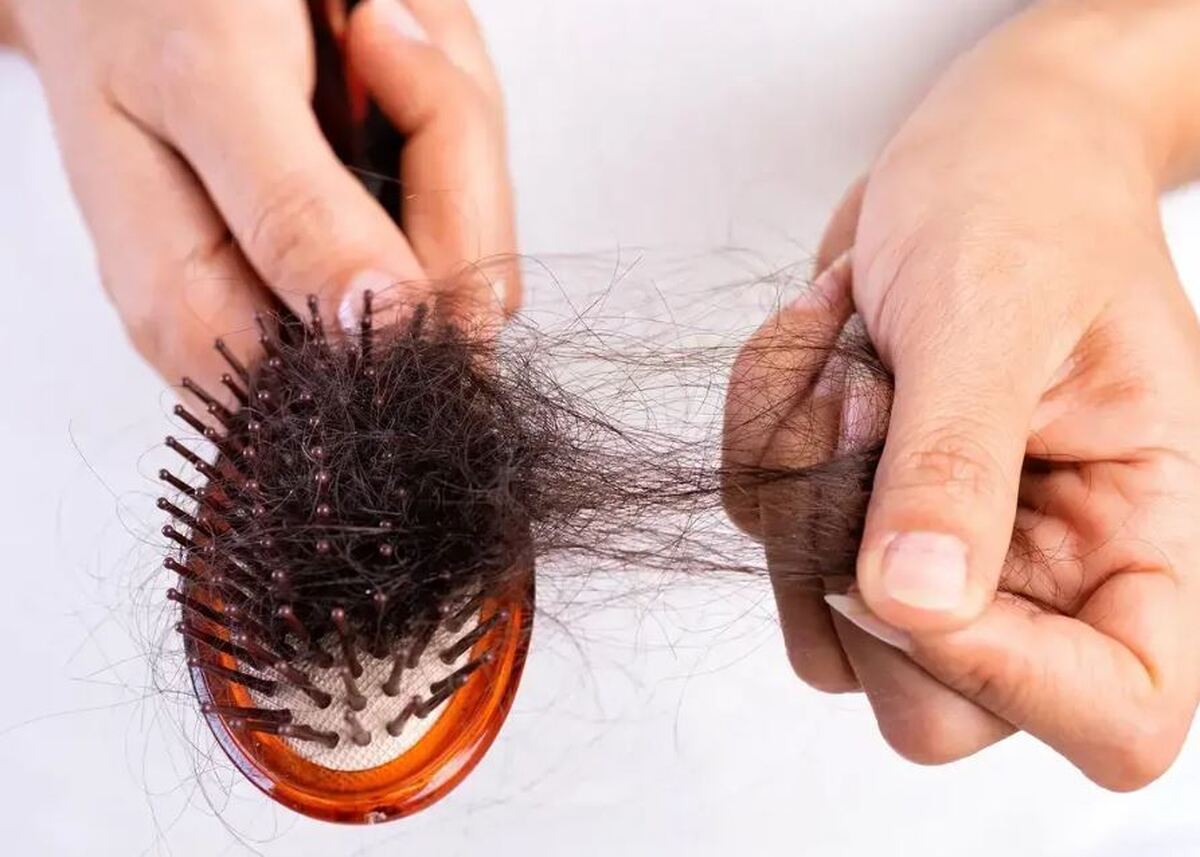 هشدار؛ این غذاها ریزش موی شما را بیشتر می‌کند