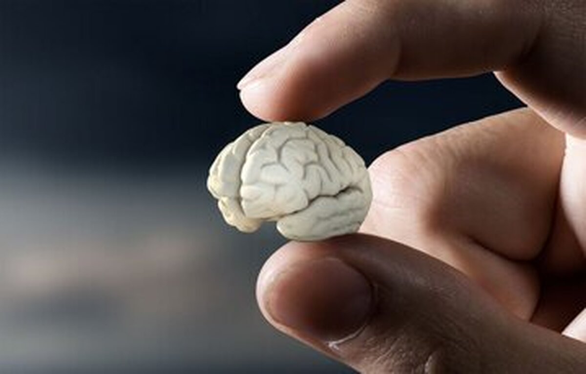 چرااین افراد حجم مغز کمتری دارند؟ چرااین افراد حجم مغز کمتری دارند؟