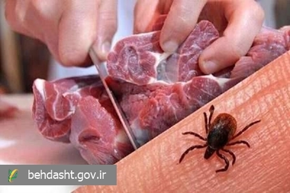 همهچیز درباره تب کریمه کنگو؛ بیماری خطرناک مشترک بین انسان و دام همهچیز درباره تب کریمه کنگو؛ بیماری خطرناک مشترک بین انسان و دام