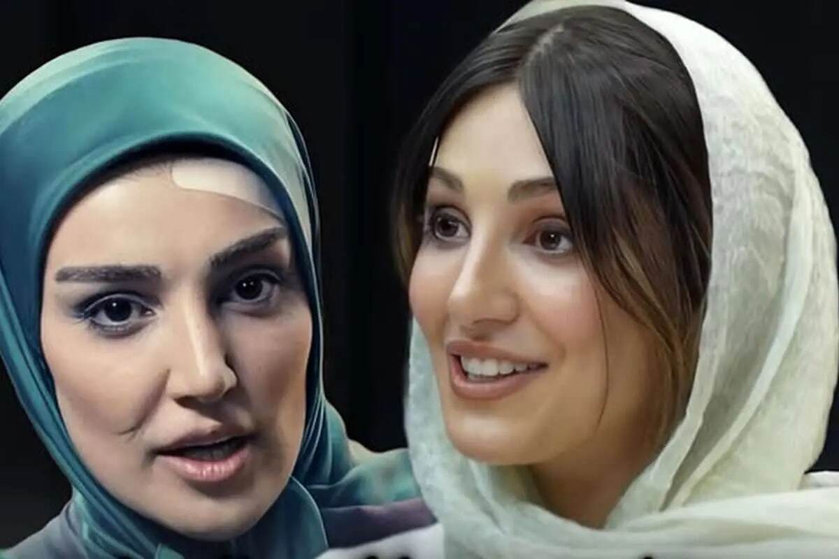 همه عمل های زیبایی زارا نادری فر / هوژان سریال ناریا چند ساله است؟ + فیلم