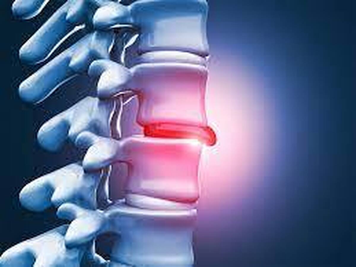 اگر دچار دیسک کمر هستید حتما این فیلم را ببینید