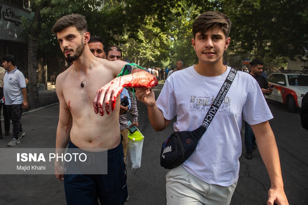 تصاویر تلخ از مصدومان انفجار در بلوار کشاورز تهران
