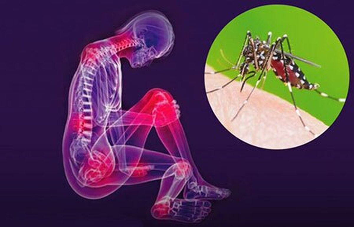 شیوع یک بیماری ویروسی جدید / ثبت ۹۰ مورد فوتی
