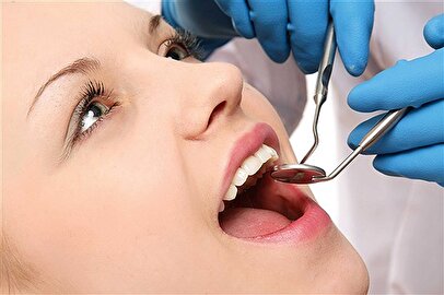 رنگ دندان‌ها را جدی بگیرید / این رنگ  علائم مرگ است!