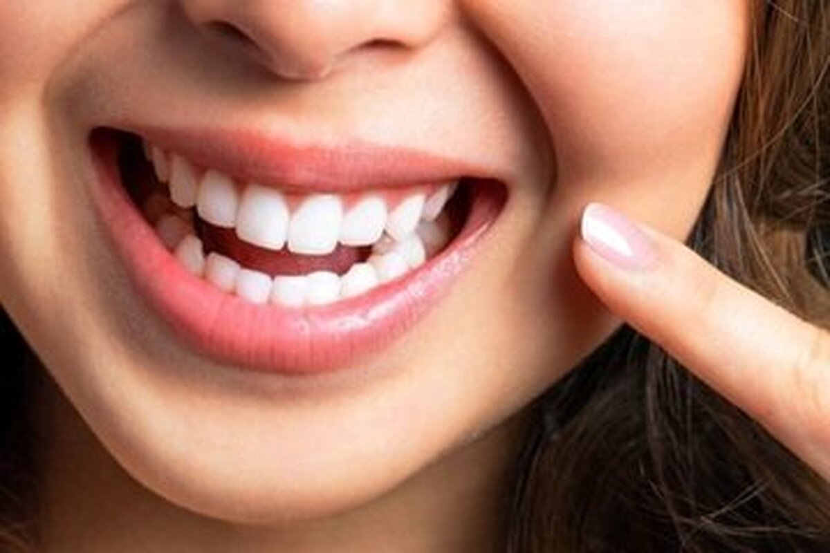 با این ویتامین‌ها دندان‌هایی سفید داشته باشید