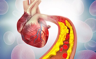 یک روش ساده برای کاهش کلسترول خون