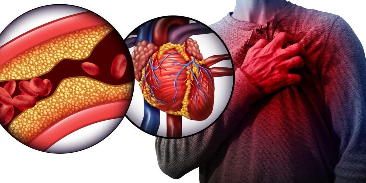 چند راهکار ساده خانگی برای کاهش کلسترول چند راهکار ساده خانگی برای کاهش کلسترول