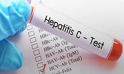 طرح بزرگ وزارت بهداشت آغاز شد