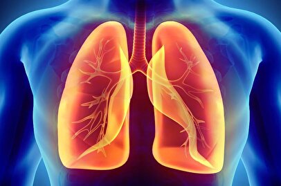 ابتلای ۶ ایرانی به یک بیماری خطرناک ریوی / ۸ استان در وضعیت خطرناک