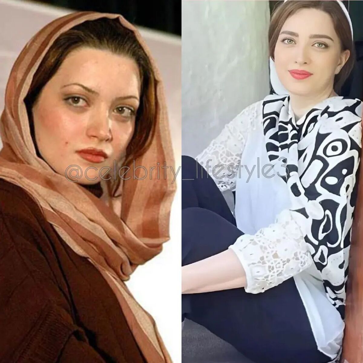 بهنوش طباطبایی قبل از عمل سنگین زیبایی+ فیلم