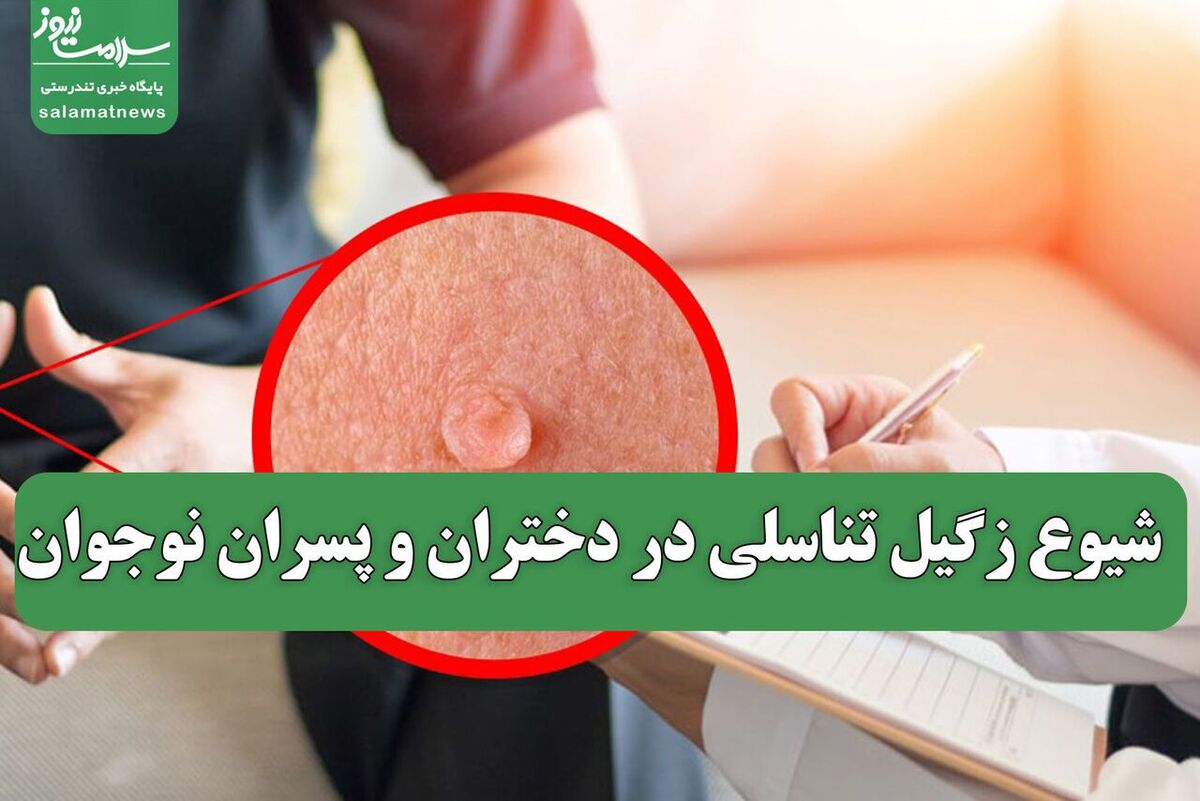 مینو محرز خبر داد؛ شیوع زگیل تناسلی در دختران و پسران نوجوان