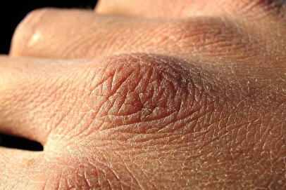 چرا بدن در پاییز تشنه‌تر است؟/ بهترین راهکار برای درمان کم آبی بدن چیست؟