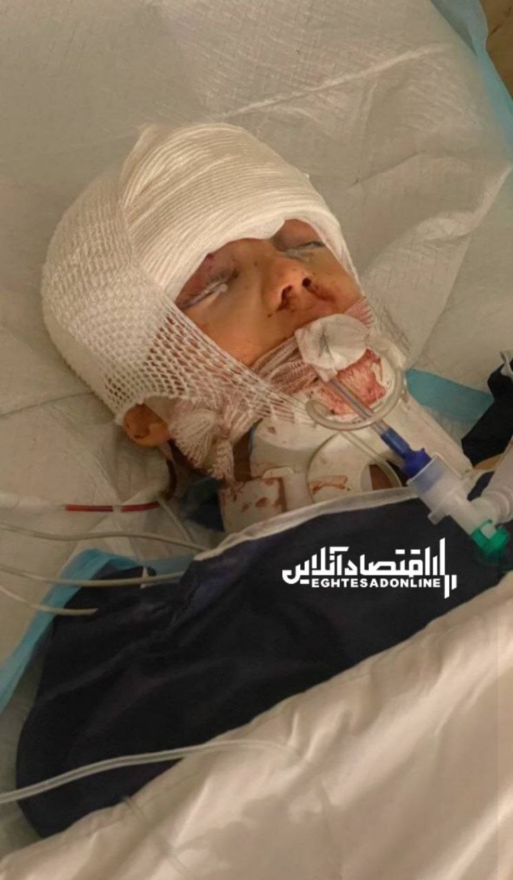 همه مردم ایران در حال دعا/محمد سبحان پسر معاون رییس جمهور در شرایط بحرانی همه مردم ایران در حال دعا/محمد سبحان پسر معاون رییس جمهور در شرایط بحرانی