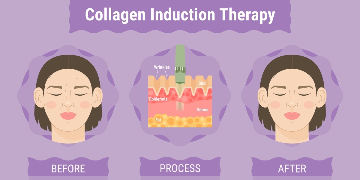 چگونه در سایت الانزا یک روتین مراقبتی کامل با بهترین قیمت انتخاب کنیم؟