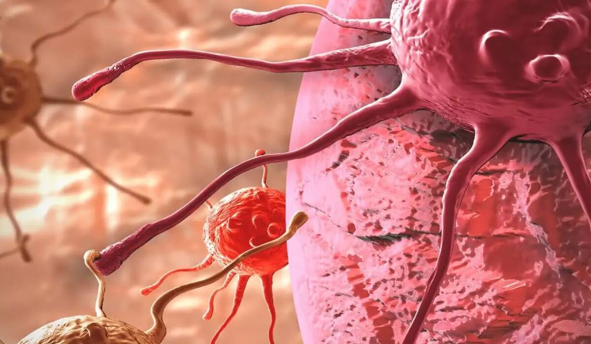 علائم هشداردهنده سرطان بشناسید/ این نشانه‌ها را به‌موقع پیگیری کنید