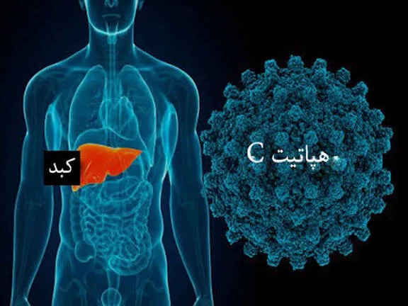 هپاتیت