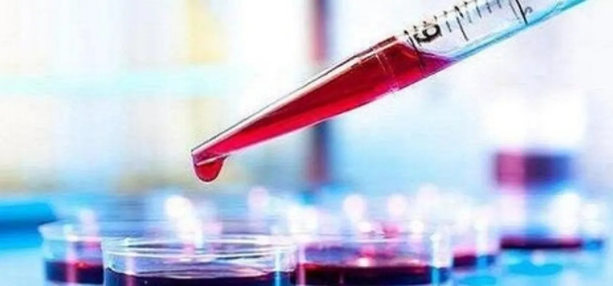 تشخیص آلزایمر با یک آزمایش ساده
