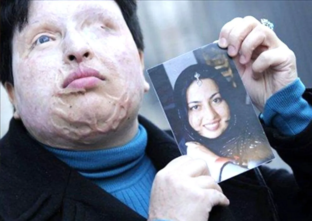آمنه بهرامی به دادسرای جنایی تهران رفت!