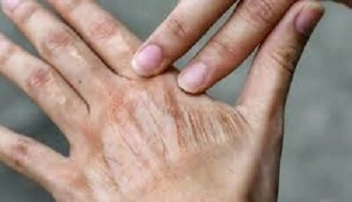 تأثیر عجیب آلودگی هوا بر پیری پوست